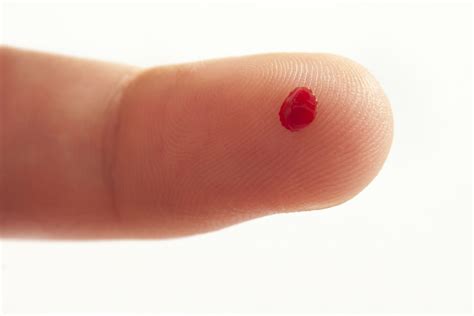 blood drop medical test|one drop blood test.